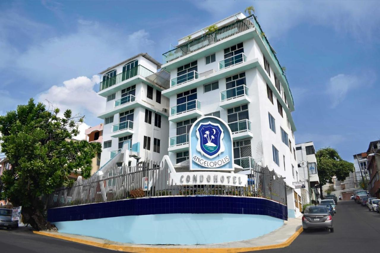 Suites Angelopolis 아카풀코 외부 사진